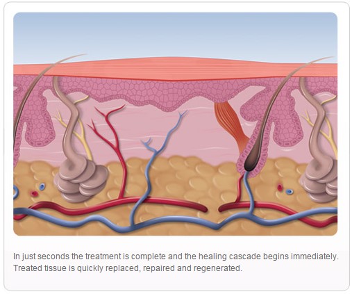tissue regenerating after treatment